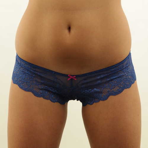 13 Tips to Avoid Panty Lines